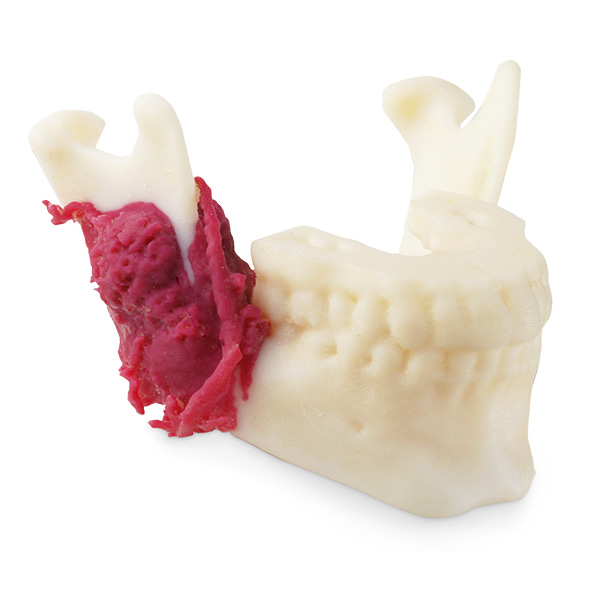 Biomodelo de mandíbula e maxila da ba•io