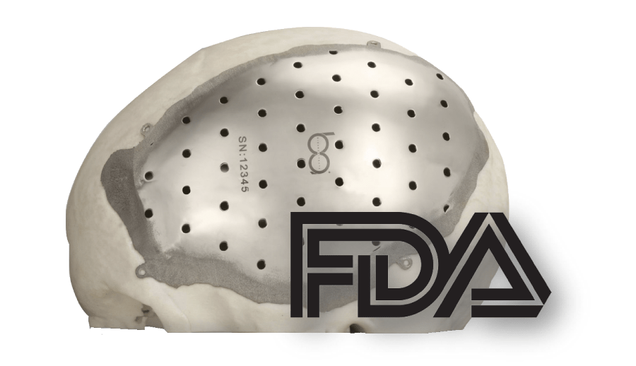 Calota da ba•io aprovada pela FDA